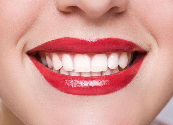 Teeth whitening after photo with white teeth